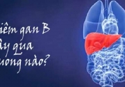 Những câu hỏi thường gặp về bệnh viêm gan B